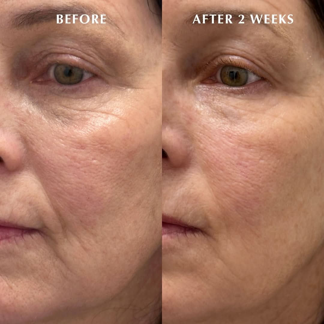 Before and After photo 2 weeks