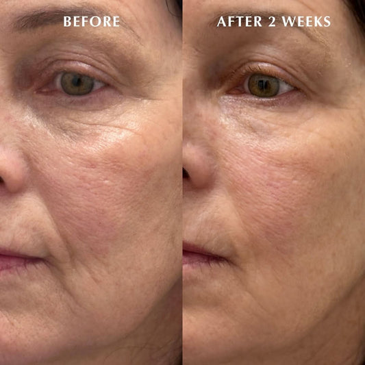 Before and After photo 2 weeks