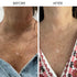 closeup of neck and décolletage before and after VITAMIN C PLUMPING SERUM