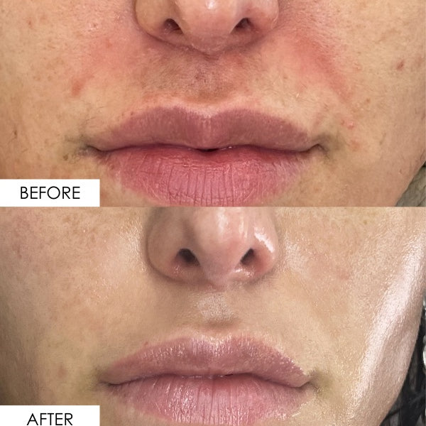Split image of actual customer showing positive before and after results from BAKUCHIOL WONDER SERUM