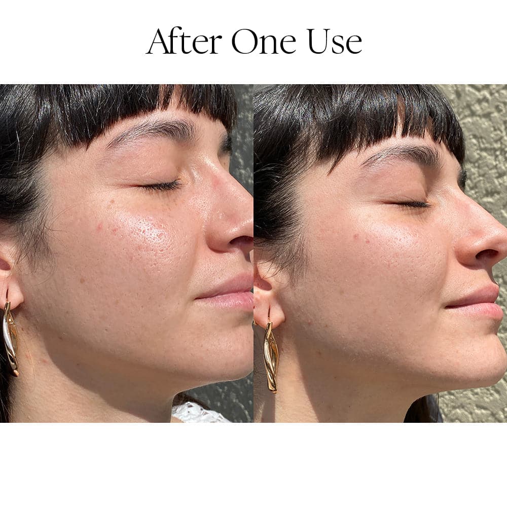 A before and after image of a pretty dark-haired girl. The before image showing some oily shine and hyperpigmentation, and the after showing a pretty and smooth, even toned complexion.